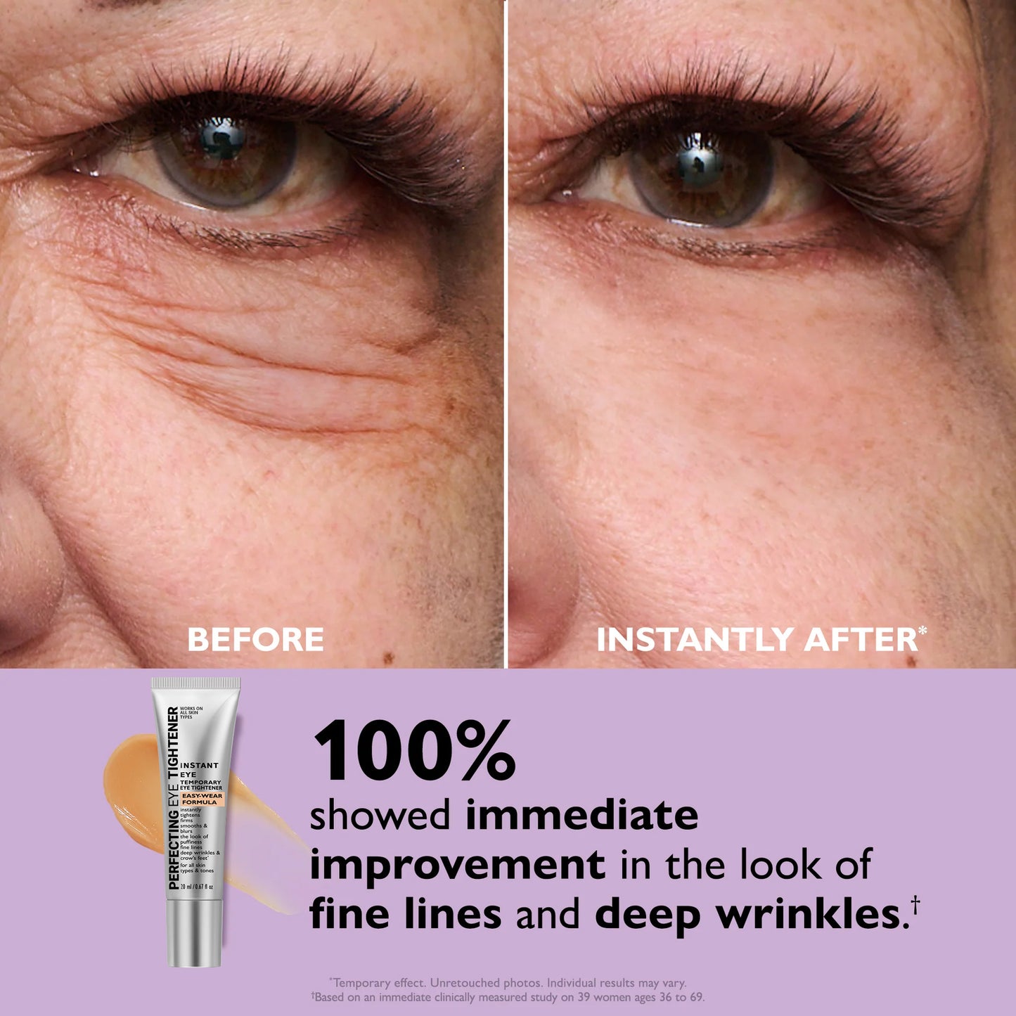 🌸[Official Store] 🌸 Instant Ageless Repair Serum | Visibly Tighter in sixty seconds. Lasts All Day.